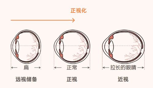 远视储备余额不足,小心近视