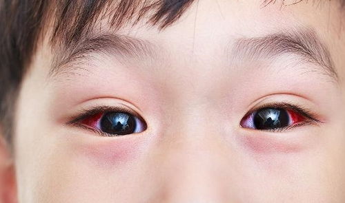 为何近视的人越来越多？每天给孩子吃这些，就别怪他视力越来越差